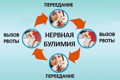 Лечение булимии в Еманжелинске